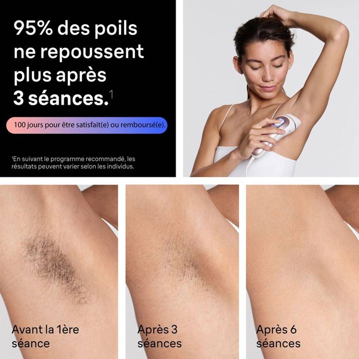 Braun - Épilateur à lumière pulsée IPL Skin i-expert Pro PL7431, capteur SkinProtect, 4 têtes - Braun - Image 4